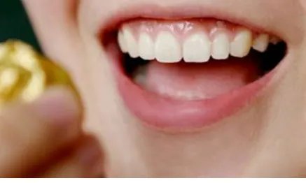 深圳种植牙需要多少钱