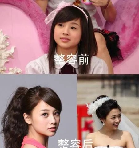 吴映洁为什么叫鬼鬼？整容前后对比照曝光（图）