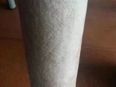 慢性湿疹小腿症状图片