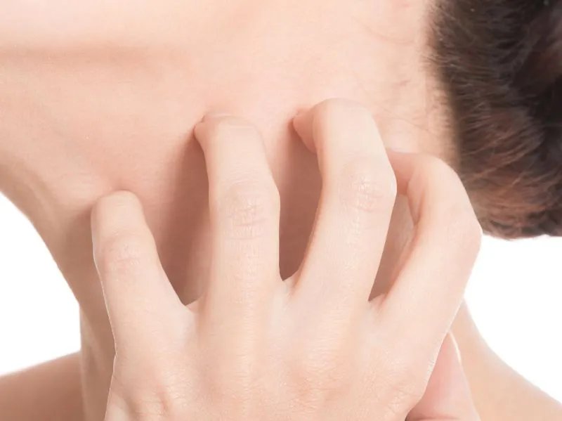 腿部皮肤过敏怎么办