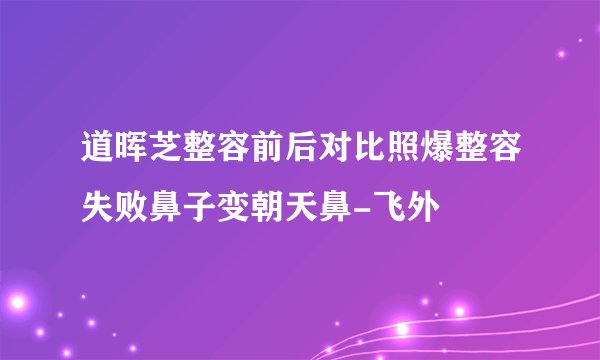 道晖芝整容前后对比照爆整容失败鼻子变朝天鼻-飞外