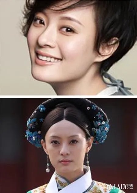 揭露孙俪唇痣车祸造成的内幕稳坐陆剧女王宝座的心酸之路