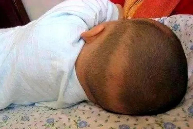 小宝宝佝偻病症状图片