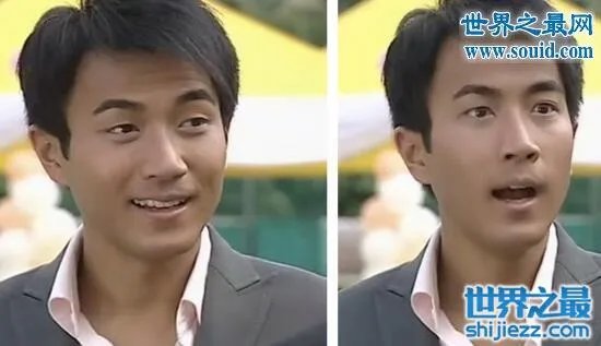 刘恺威整容前后照片曝光，五官全整简直大换脸 