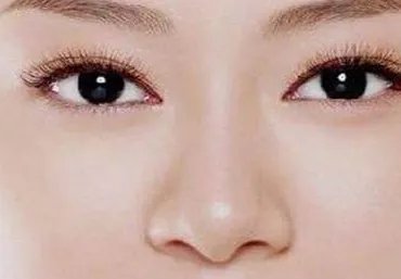 北京隆鼻修复医院哪家好