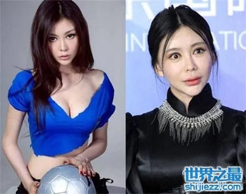 巩新亮整容前后差异大 网友直呼惨不忍睹