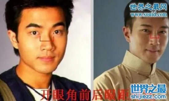 刘恺威整容前后照片曝光，五官全整简直大换脸 