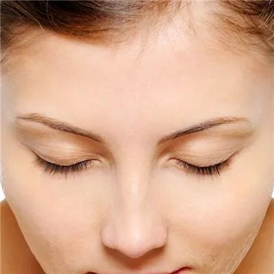 鼻子上挤出白色的东西是什么