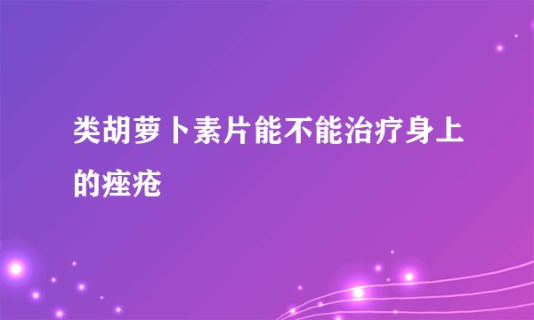 类胡萝卜素片能不能治疗身上的痤疮