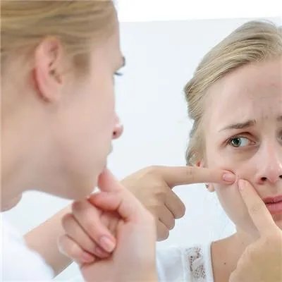 鼻子上挤出白色的东西是什么