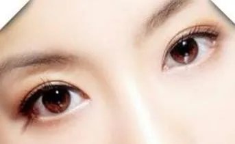 双眼皮吸脂价格是多少