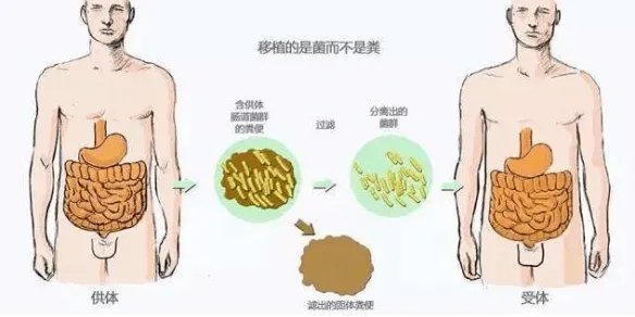 无锡一医院号召志愿者捐献粪便救人:治疗相关疾病