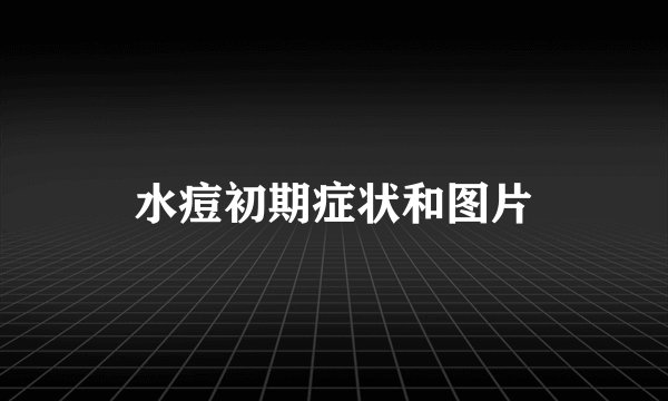水痘初期症状和图片