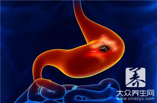 消化道传染病有哪些