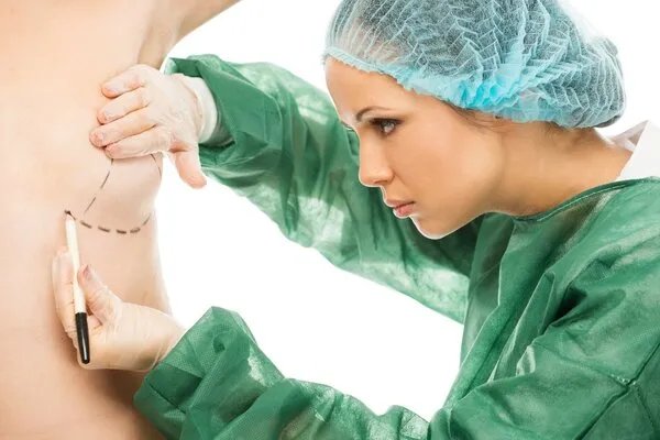 一般自体丰胸手术多少钱