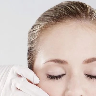 消除痘印用什么好