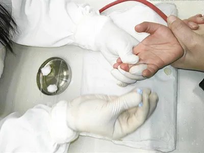 皮肤上出现白色斑块-皮肤上出现白色斑块是什么原因