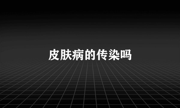 皮肤病的传染吗