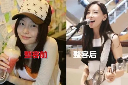 于文文整容了吗？于文文承认整容前后照片对比