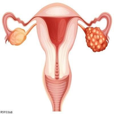 阴道前庭脱垂有什么症状