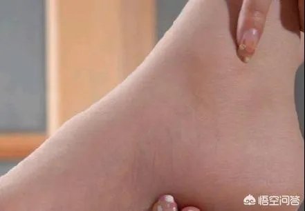 脚扭伤了怎么好的快?