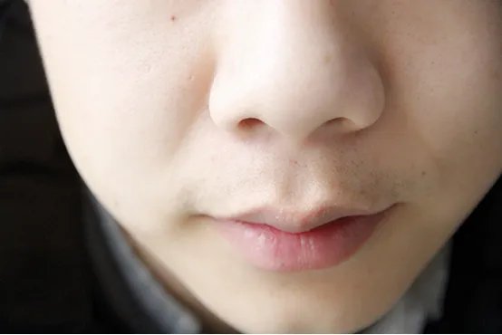 法令纹怎么消除