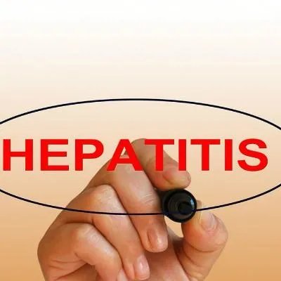 牛皮癣怎样治疗是最好