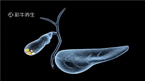 胆囊结石的治疗方法