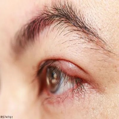 手术眼部除皱效果如何