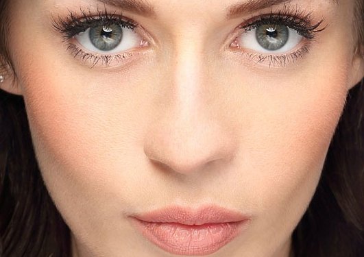 果酸祛斑的价位