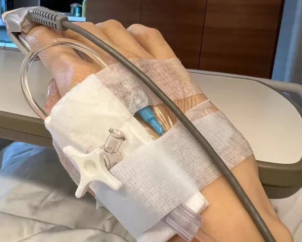 51岁李嘉欣病危住进ICU，她的身体出现了什么问题？