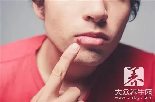  唇炎挂什么科彻底治好