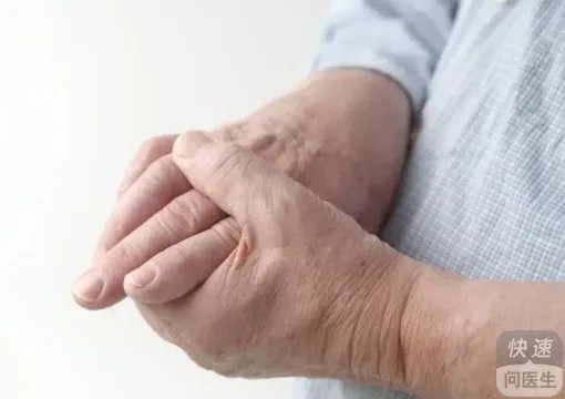 手脚麻木吃寿星补汁有效果吗？具体情况具体分析