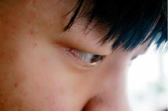 眼睛胀痛是怎么回事