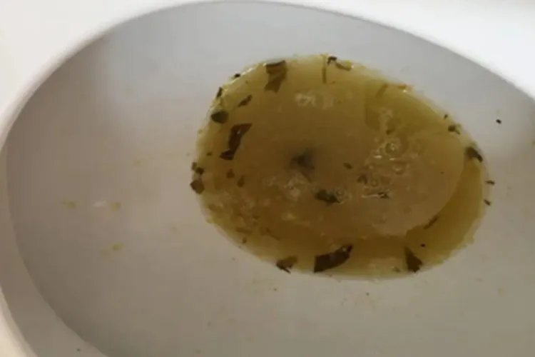 炭疽病腹部症状图片