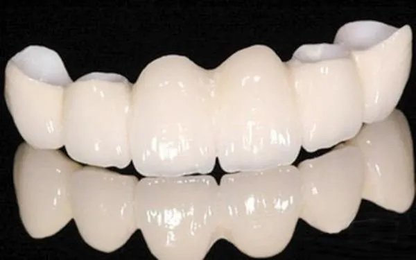 镍铬合金烤瓷牙价格