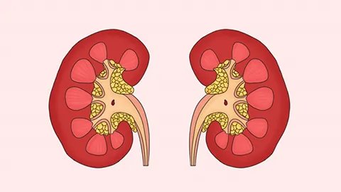 肾良性肿瘤有什么症状