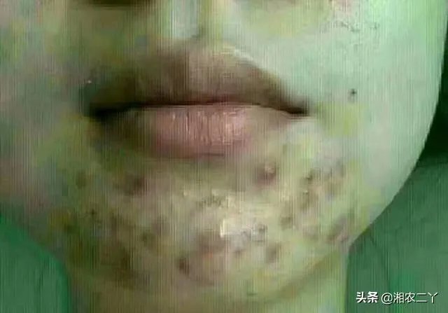 去美容院有用吗？