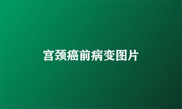 宫颈癌前病变图片