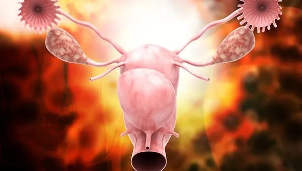 附件囊肿是怎样形成的