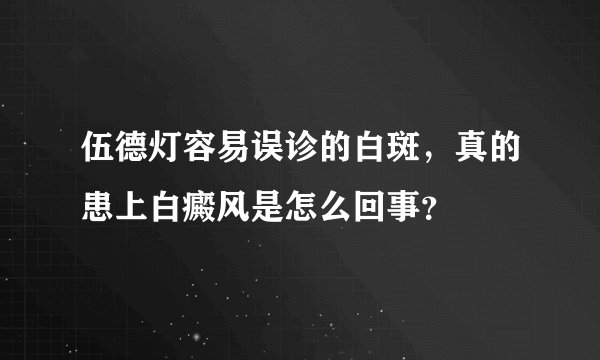 伍德灯容易误诊的白斑，真的患上白癜风是怎么回事？