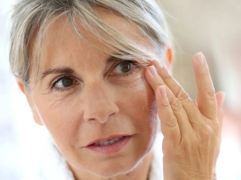 眼部细纹怎么办