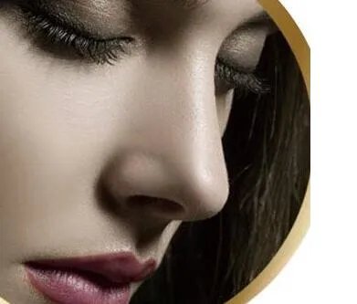 假体隆鼻后遗症