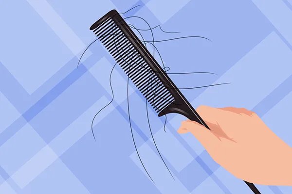 掉头发是什么原因引起的