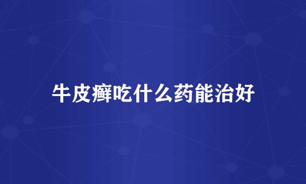 牛皮癣吃什么药能治好