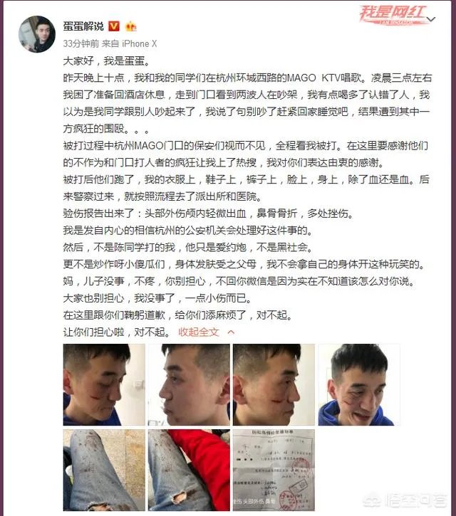 贝拉拉是谁，最近为什么这么火？听说他在工体被打了？