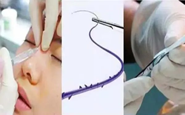 北京肋软骨隆鼻口碑好的医院是哪家