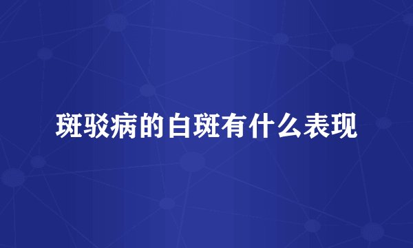 斑驳病的白斑有什么表现