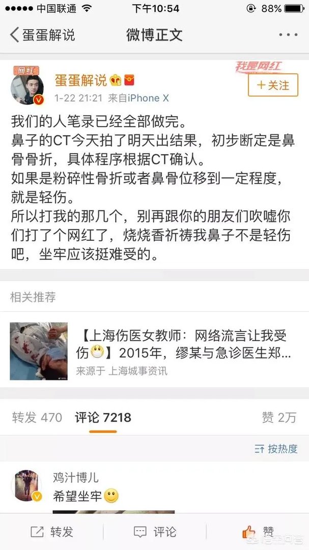 贝拉拉是谁，最近为什么这么火？听说他在工体被打了？