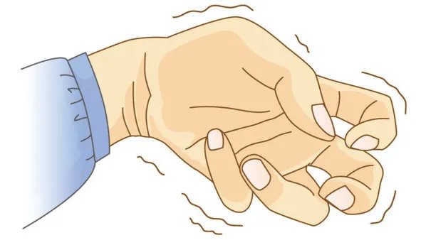 癫痫病发作时怎么办